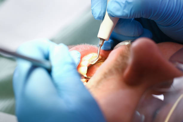 Best Urgent Dental Care for Toothache in Memphis, FL