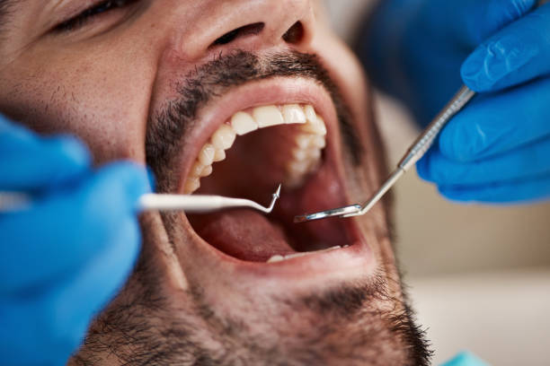 Best Mobile Emergency Dentist in Memphis, FL