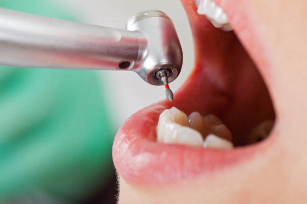 Best Emergency Cosmetic Dentistry in Memphis, FL